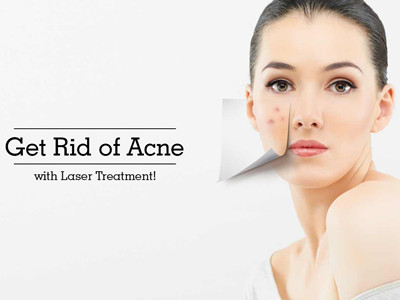 acne treatment